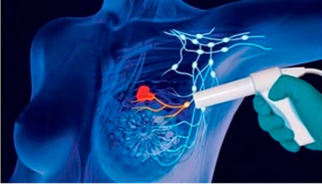 Avances nas novas tecnoloxías para o diagnóstico e  radiotratamiento do cancro